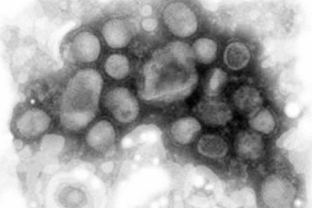 Na fot. wirus A/H1N1 Wirus A/H1N1 dotarł do Polski