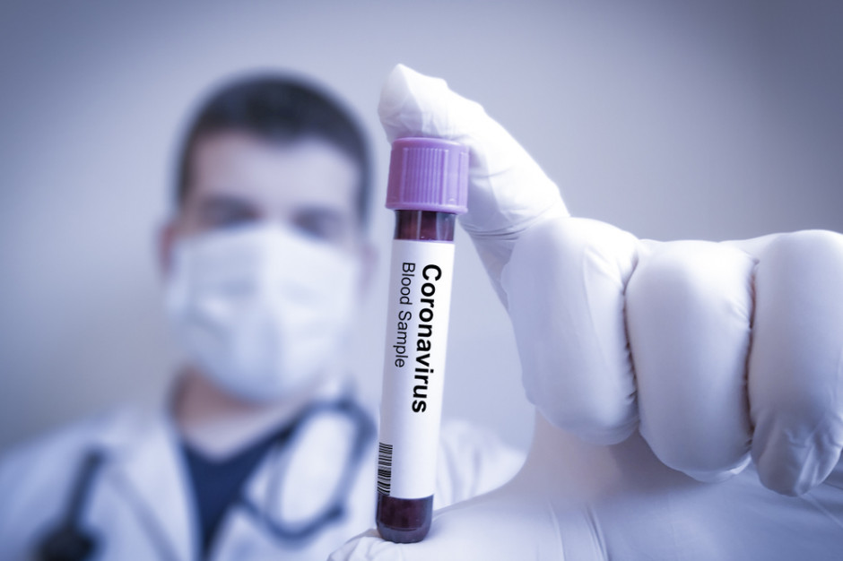 Eksperci: Polska może zyskać na epidemii koronawirusa, fot. shutterstock Eksperci: Polska może zyskać na epidemii koronawirusa