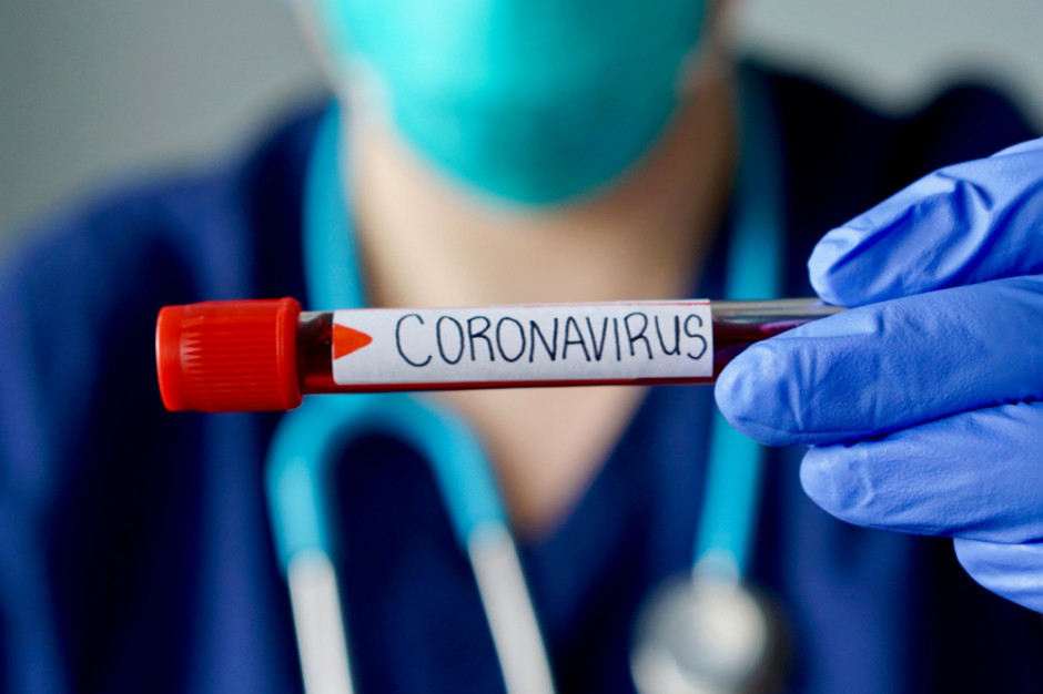 Ponad 16 mln potwierdzonych przypadków Covid-19 na świecie/ fot. shutterstock Ponad 16 mln potwierdzonych przypadków Covid-19 na świecie